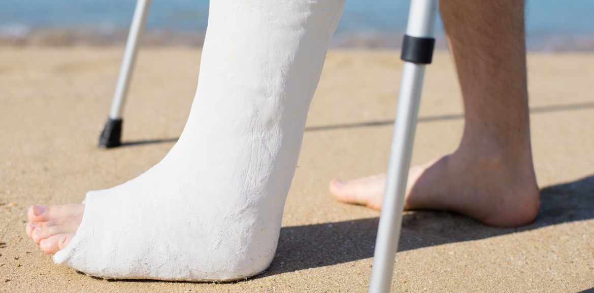 man with casted leg on beach | Coastline Realty Vacations